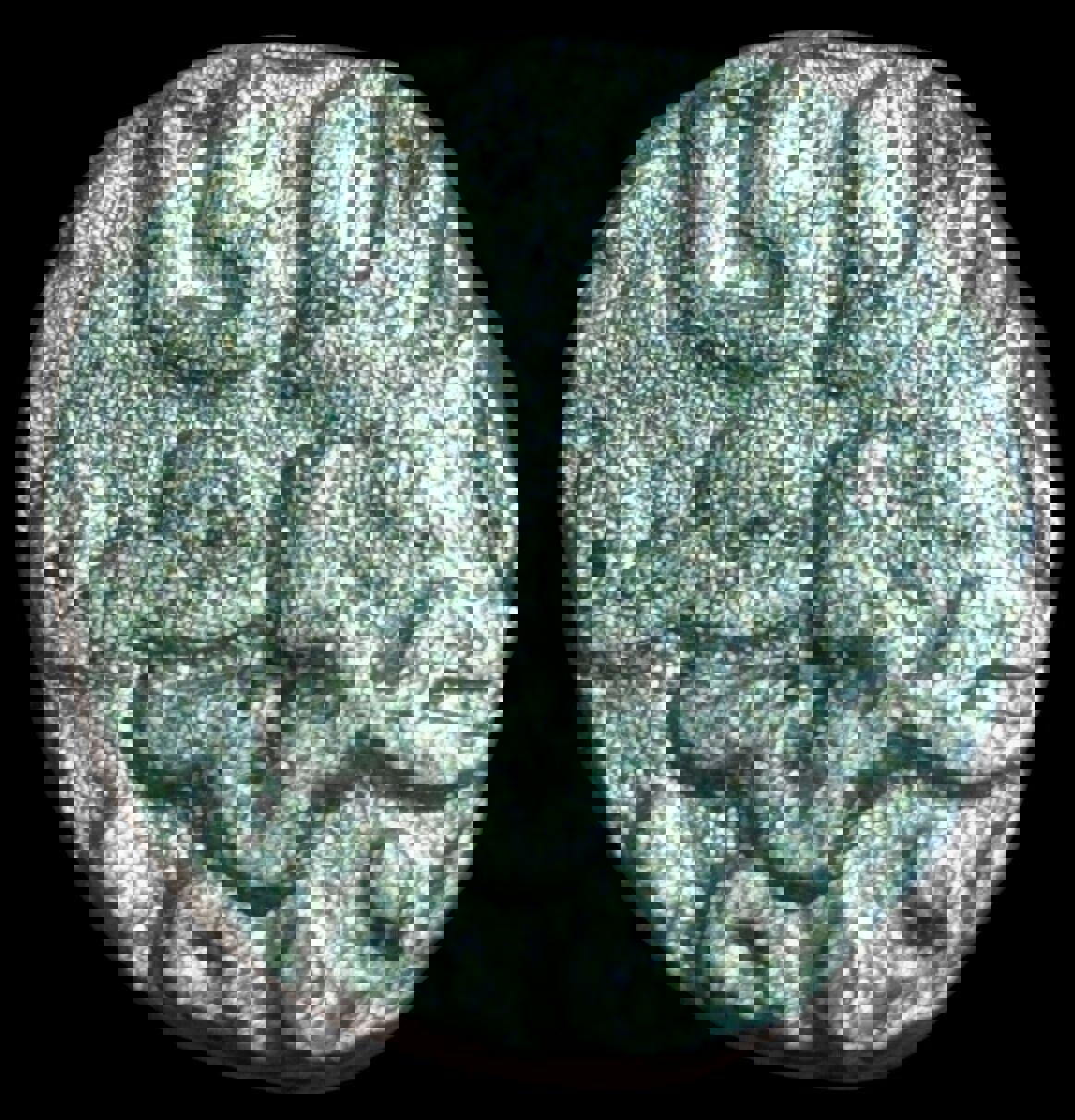 Sultans of Delhi.   Ghiyath al-Din Balban, 1266-1287AD   Billon 2 Gani